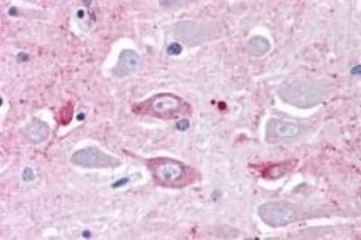 Immunohistochemistry: MRGPRD Antibody [NBP3-14409]